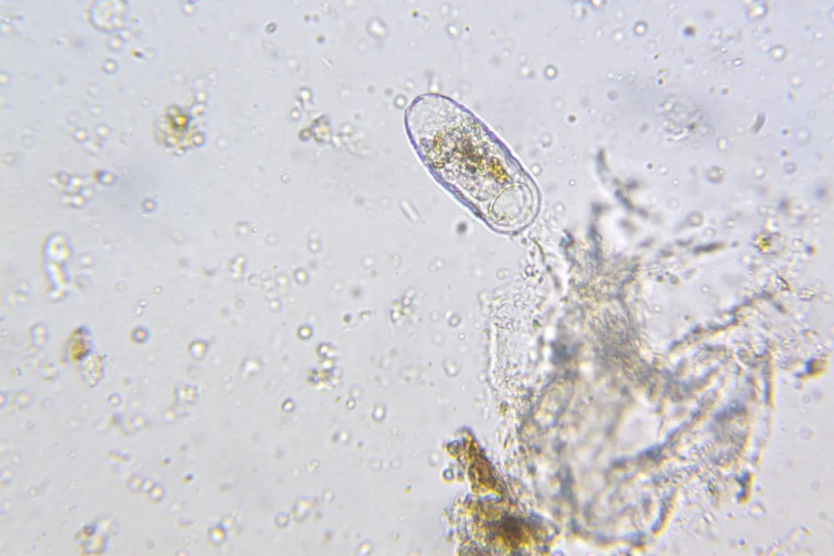 Online cursus bodemvoedselweb-microscopie start in februari 2026