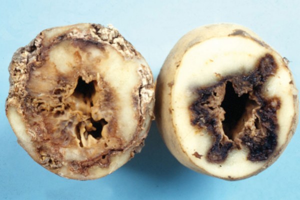 New strains of potato-threatening pathogens discovered in Pennsylvania - Vimarsana News